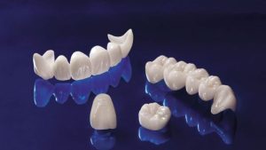 Răng sứ Cercon -2